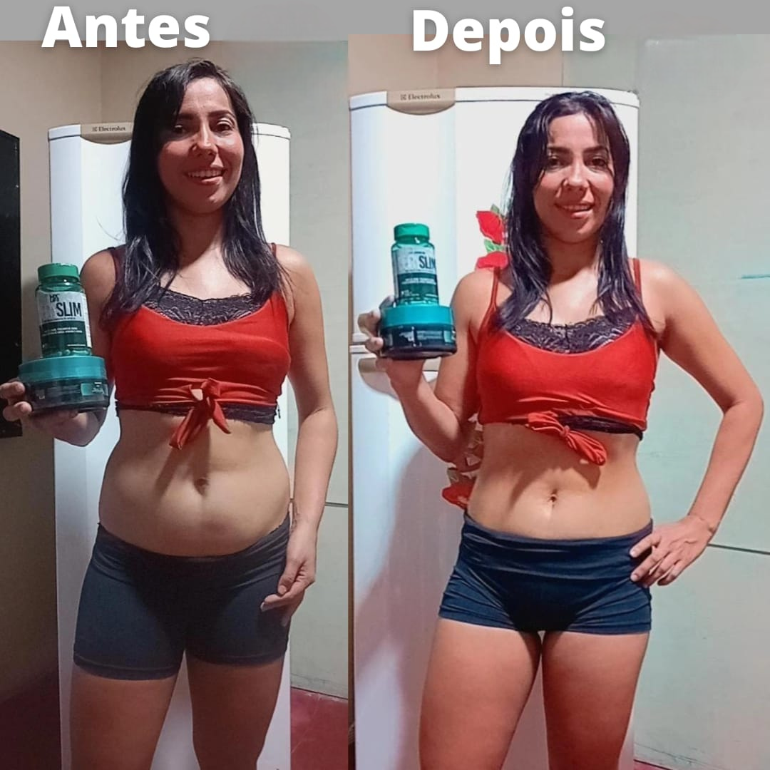 Antes e Depois 1
